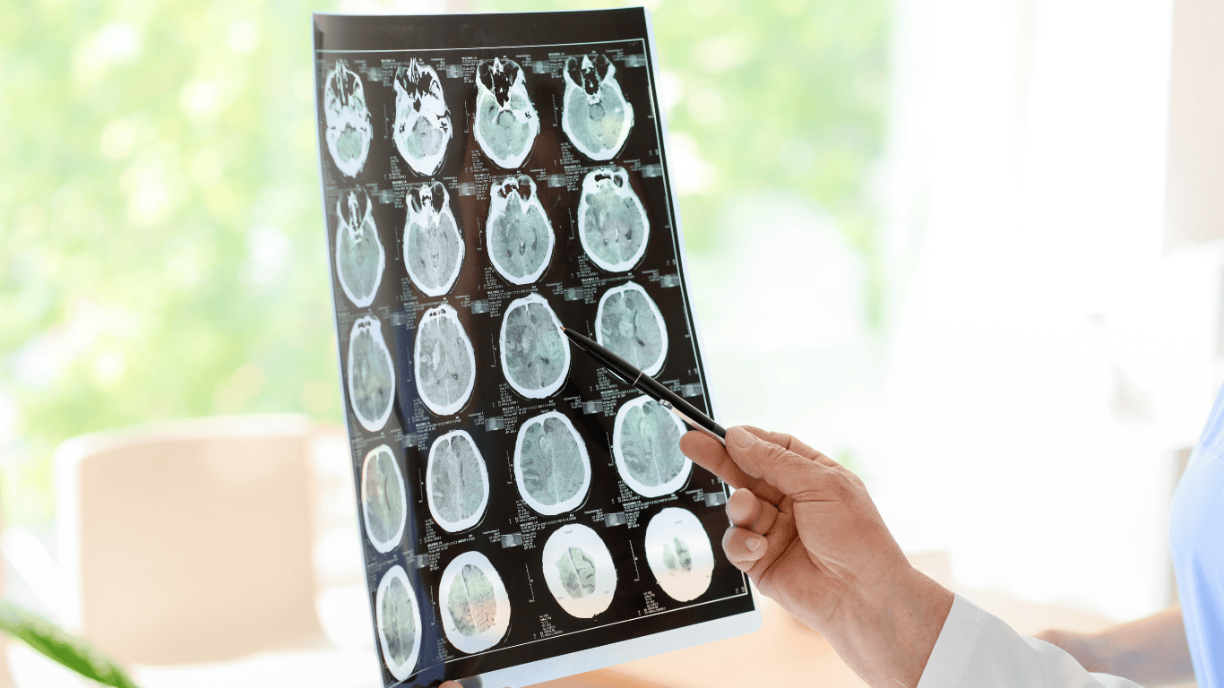 Paket Brain Check Up